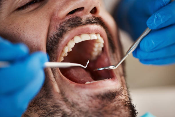 Best Knocked-Out Tooth Emergency  in Clancy, MT